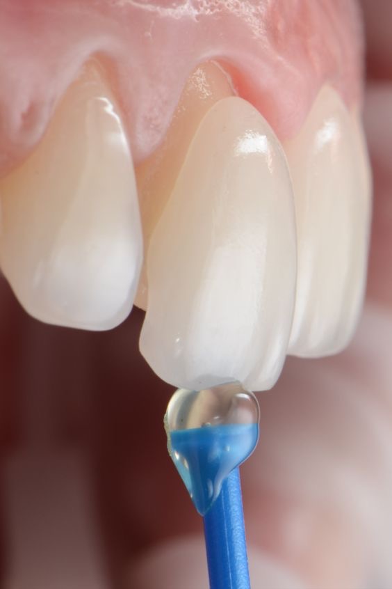 لمینیت دیجیتال